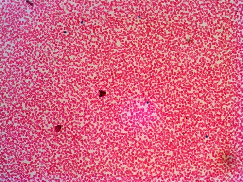 immagine di Set di vetrini preparati Levenhuk N38 NG,  16