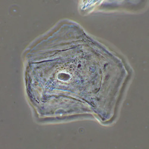 foto di Dispositivo a contrasto di fase MAGUS SPH2,  16