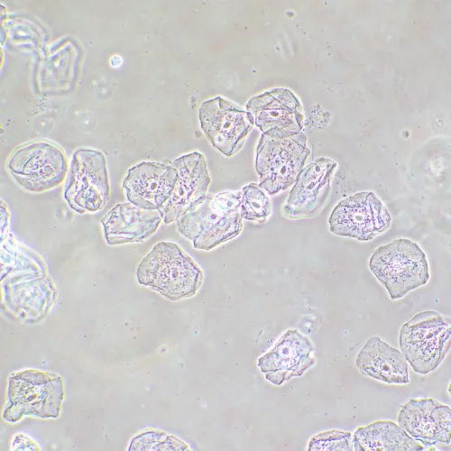 foto di Dispositivo a contrasto di fase MAGUS SPH2,  14
